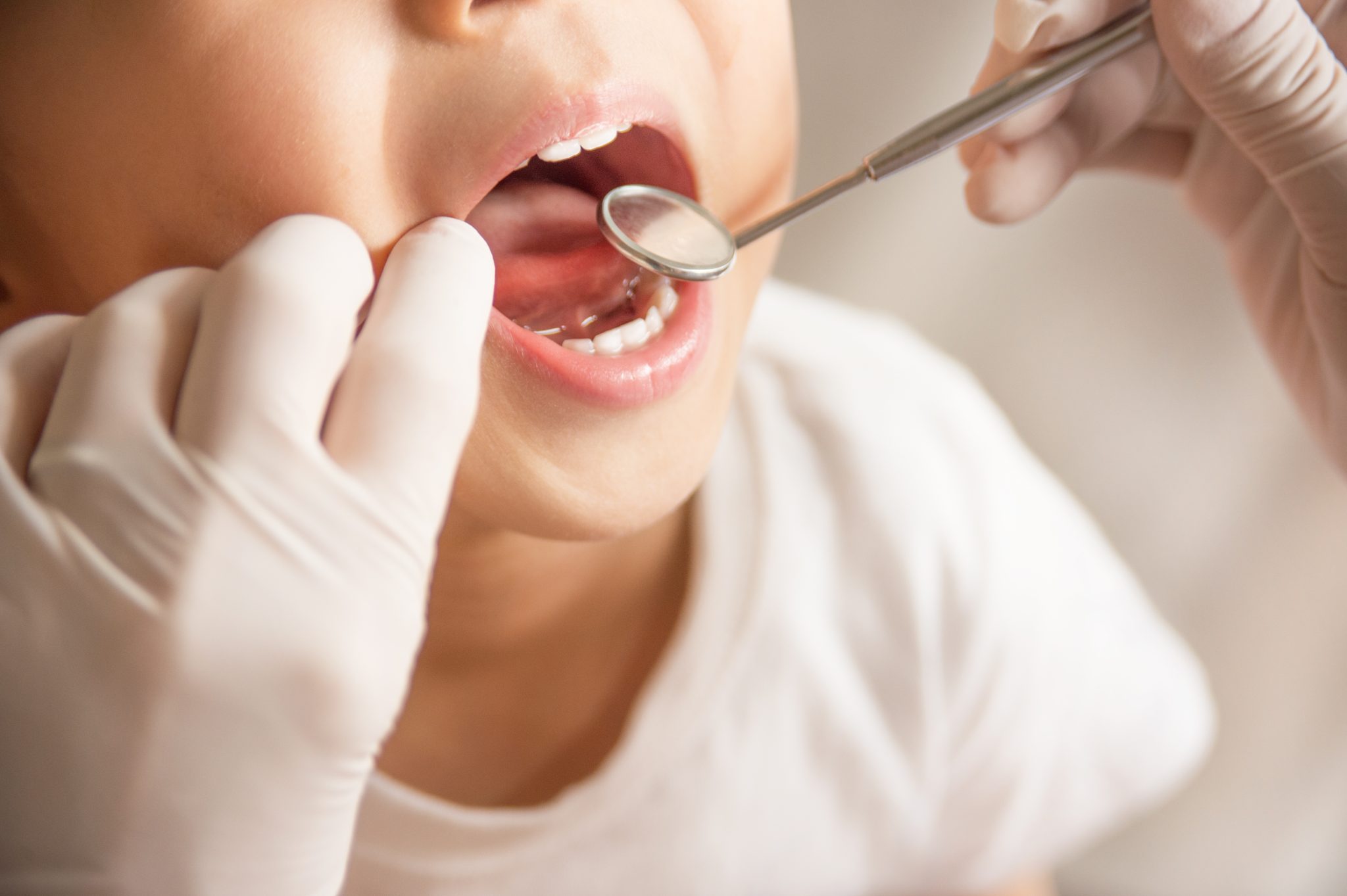 Dentist examining young child's teeth with dental mirror