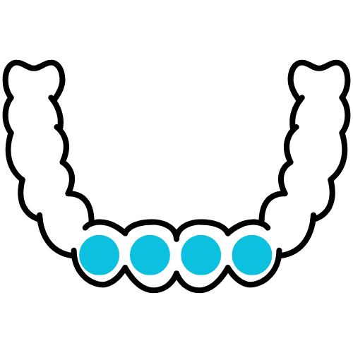 a row of bottom teeth with four marked aligned teeth