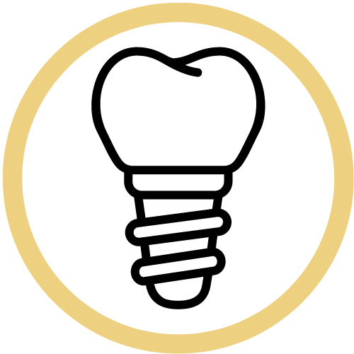 a graphic drawn image of a sample dental teeth implant