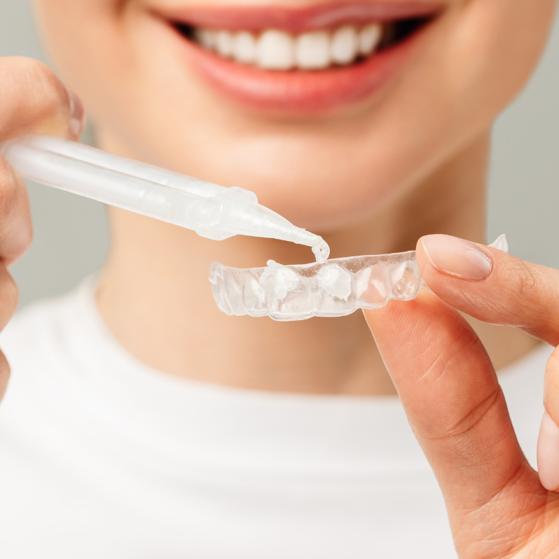 Woman applying whitening gel to clear dental tray