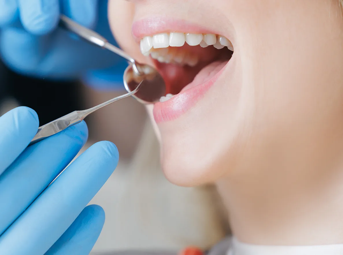 Dentist examining patient's teeth with dental mirror tool