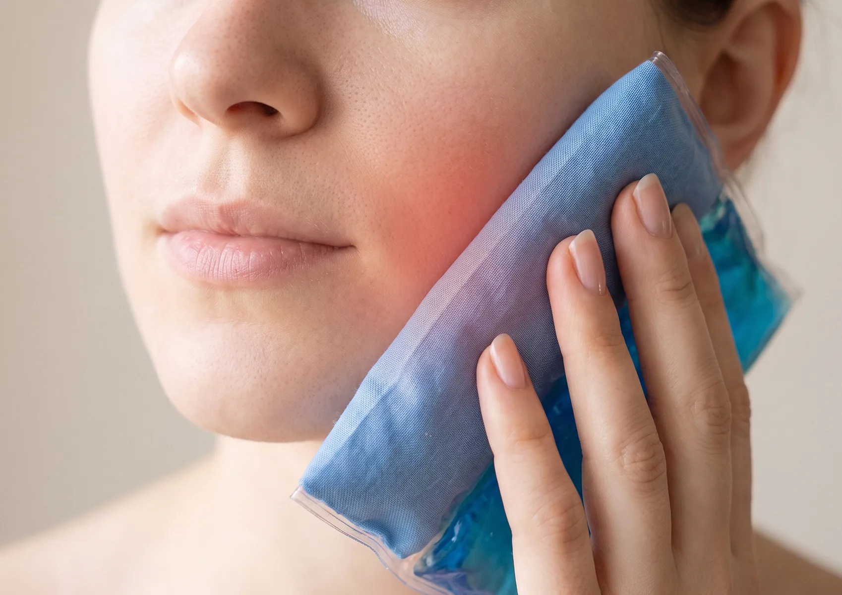 Woman applying ice gel pack to swollen red cheek