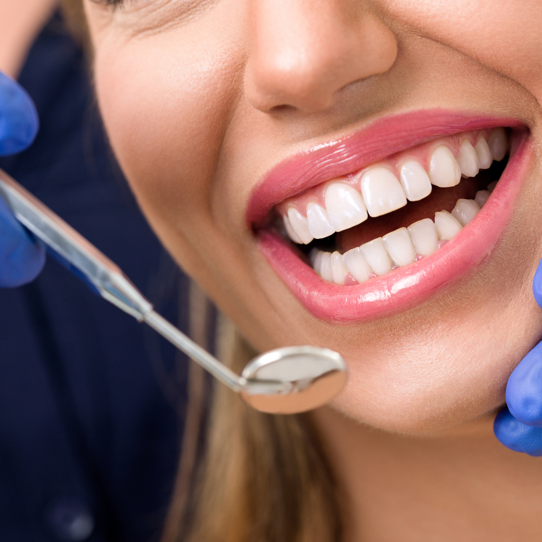 a woman smiling for a dentist holding a mirror