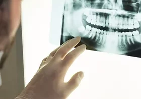 X-rays