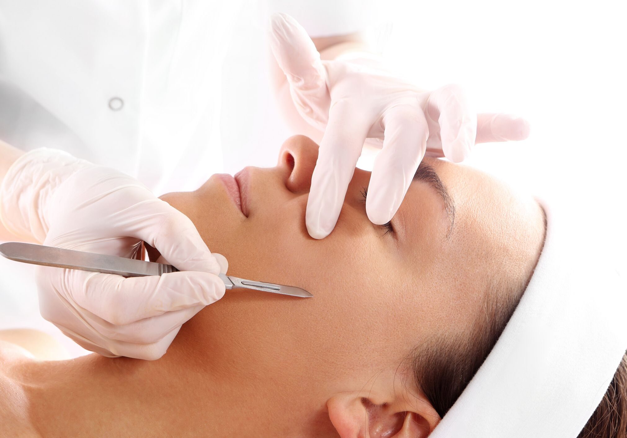 microneedling close up