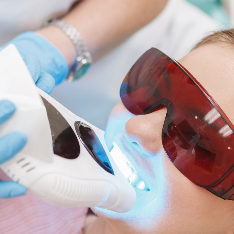 a girl undergoing teeth lab whitening with a powerful light